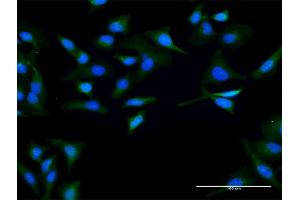 Immunofluorescence of purified MaxPab antibody to SPO11 on HeLa cell.