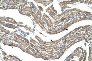 Image no. 1 for anti-Asporin (ASPN) (AA 250-299) antibody (ABIN203462) (Asporin Antikörper  (AA 250-299))