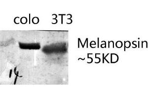 Western blot analysis of various lysates using Melanopsin Polyclonal Antibody. (OPN4 Antikörper  (AA 400-480))