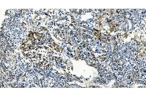 IHC analysis of TMBIM1 using anti-TMBIM1 antibody (ABIN7603190).