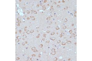 Immunohistochemistry of paraffin-embedded mouse brain using COPG2 antibody (ABIN7266426) at dilution of 1:100 (40x lens). (COPG2 Antikörper  (AA 542-871))