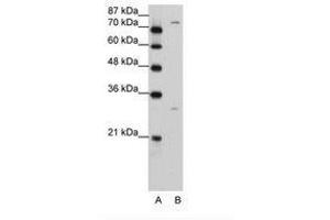 Image no. 2 for anti-Prostaglandin-Endoperoxide Synthase 1 (Prostaglandin G/H Synthase and Cyclooxygenase) (PTGS1) (AA 51-100) antibody (ABIN203401) (PTGS1 Antikörper  (AA 51-100))