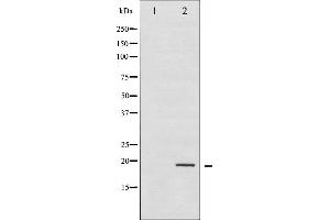 Western blot analysis of Stathmin 1 phosphorylation expression in PMA treated Jurkat whole cell lysates,The lane on the left is treated with the antigen-specific peptide. (Stathmin 1 Antikörper  (pSer25))