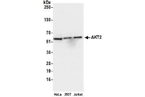 Western Blotting (WB) image for anti-V-Akt Murine Thymoma Viral Oncogene Homolog 2 (AKT2) (AA 431-481) antibody (ABIN7452696)