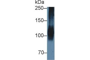 Detection of ATP1a1 in Porcine Cerebrum lysate using Polyclonal Antibody to ATPase, Na+/K+ Transporting Alpha 1 Polypeptide (ATP1a1) (ATP1A1 Antikörper  (AA 493-660))