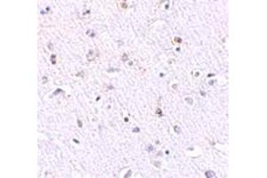 Immunohistochemical staining of human brain tissue with 2. (Nanos Homolog 1 Antikörper  (N-Term))