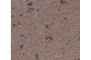 Figure. (PER1 Antikörper  (AA 208-414))