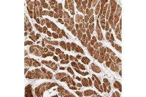 Immunohistochemical staining of human heart muscle with TRIM11 polyclonal antibody  shows strong cytoplasmic positivity in myocytes at 1:20-1:50 dilution. (TRIM11 Antikörper)