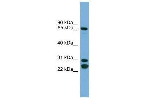 Western Blot showing DNAI2 antibody used at a concentration of 1-2 ug/ml to detect its target protein. (DNAI2 Antikörper  (N-Term))