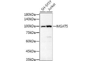 Western blot analysis of extracts of various cell lines, using MG Rabbit pAb antibody (ABIN6132962, ABIN6143817, ABIN6143818 and ABIN6214861) at 1:500 dilution.