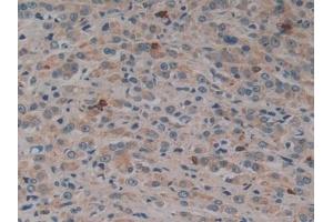 Immunohistochemistry (IHC) image for anti-Dynamin 2 (DNM2) (AA 533-731) antibody (ABIN7433204)