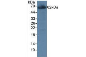 Figure. (CES1 Antikörper  (AA 19-300))