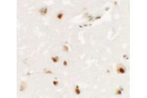 Immunohistochemistry of SHANK3 in human brain tissue with SHANK3 antibody at 2. (SHANK3 Antikörper  (Middle Region))