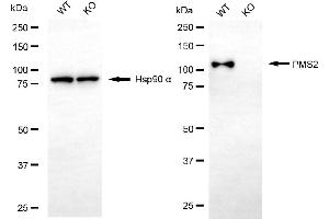 Western blotting analysis using PMS2 antibody (ABIN7799858). (Rekombinanter PMS2 Antikörper)