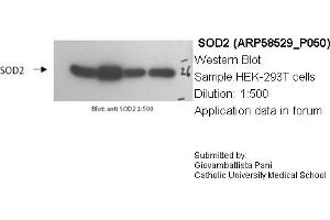Western Blotting (WB) image for anti-Superoxide Dismutase 2, Mitochondrial (SOD2) (N-Term) antibody (ABIN2787727)