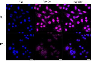 Immunocytochemical staining of HepG2 cells using FANCA antibody (ABIN7798563), 1:1,000), Top panel: wild-type (WT), Bottom panal: FANCA shRNA knockdown (KD). (Rekombinanter FANCA Antikörper)