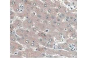 Immunohistochemistry (IHC) image for anti-Uncoupling Protein 2 (Mitochondrial, Proton Carrier) (UCP2) (AA 154-289) antibody (ABIN7428086)