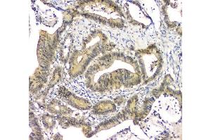 IHC analysis of EIF6 using anti-EIF6 antibody (ABIN6719594). (EIF6 Antikörper  (AA 66-210))