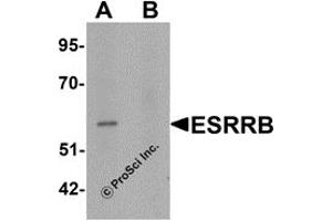 Western Blotting (WB) image for anti-Estrogen-Related Receptor beta (ESRRB) (N-Term) antibody (ABIN1031374) (ESRRB Antikörper  (N-Term))