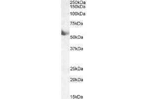 Western Blotting (WB) image for anti-Cytochrome P450, Family 1, Subfamily A, Polypeptide 1 (CYP1A1) (Internal Region) antibody (ABIN870663)