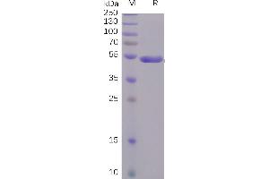 SDS-PAGE (SDS) image for SARS-CoV-2 Spike S1 (C-Term) protein (Fc Tag) (ABIN6961174)
