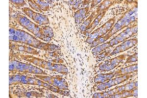 ABIN7094702 and ABIN7098753 at 1/100 staining Rat colorectal tissue by IHC-P.