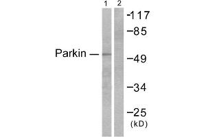 Western blot analysis of extracts from Jukat cells, using Parkin antibody (ABIN5976483). (Parkin Antikörper  (N-Term))