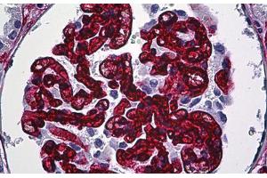 Human Kidney, Glomeruli: Formalin-Fixed, Paraffin-Embedded (FFPE) (CD34 Antikörper)