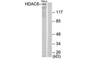 Western blot analysis of extracts from HeLa cells, using HDAC6 Antibody. (HDAC6 Antikörper  (AA 1166-1215))
