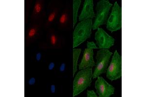 Phospho-FOXL2 (Ser263) Antibody staining A549 cells(4h of LPS treatment) by IF/ICC. (FOXL2 Antikörper  (pSer263))