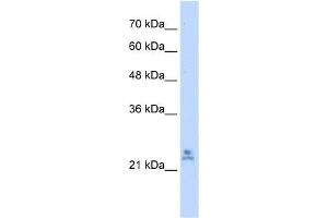WB Suggested Anti-MRPS15 Antibody Titration:  2. (MRPS15 Antikörper  (C-Term))