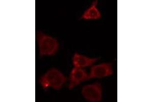 ABIN6266628 staining HeLa by IF/ICC. (RASH/RASK/RASN Antikörper)