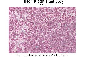 Image no. 1 for anti-E2F Transcription Factor 1 (E2F1) (Internal Region), (Lys120) antibody (ABIN571306) (E2F1 Antikörper  (Internal Region, Lys120))