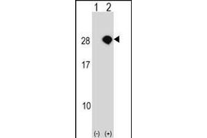 AKIRIN2 Antikörper  (C-Term)