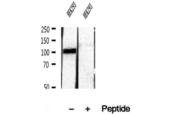 RBM15 Antikörper  (N-Term)