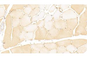 Detection of GTF2H1 in Human Skeletal muscle Tissue using Polyclonal Antibody to General Transcription Factor IIH Subunit 1 (GTF2H1) (GTF2H1 Antikörper  (AA 84-335))