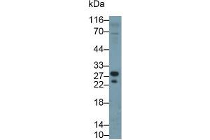 Detection of TK1 in Porcine Lymph node lysate using Polyclonal Antibody to Thymidine Kinase 1, Soluble (TK1) (TK1 Antikörper  (AA 2-234))