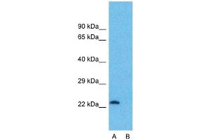 Host:  Rabbit  Target Name:  ATF3  Sample Type:  OVCAR-3  Lane A:  Primary Antibody  Lane B:  Primary Antibody + Blocking Peptide  Primary Antibody Concentration:  1ug/ml  Peptide Concentration:  5ug/ml  Lysate Quantity:  25ug/lane/lane  Gel Concentration:  0. (ATF3 Antikörper  (Middle Region))