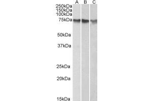 ABIN2561259 (1µg/ml) staining of HepG2 (A), K562 (B) and HeLa (C) nuclear lysates (35µg protein in RIPA buffer). (ATF2 Antikörper  (C-Term))