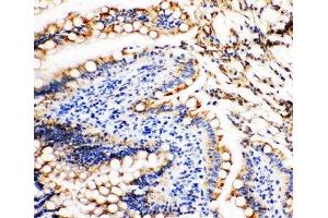 IHC-P: Vinculin antibody testing of rat intestine tissue