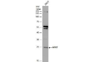 WB Image HPRT antibody detects HPRT protein by western blot analysis. (HPRT1 Antikörper)