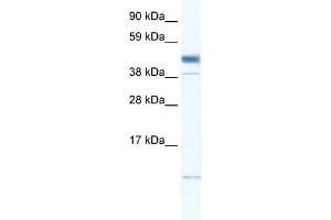 WB Suggested Anti-ZMAT1 Antibody Titration: 0. (ZMAT1 Antikörper  (Middle Region))