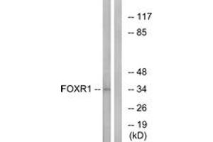 Western blot analysis of extracts from HeLa cells, using FOXR1 Antibody.