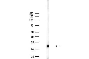 anti-Solute Carrier Family 25, Member 29 (SLC25A29) antibody