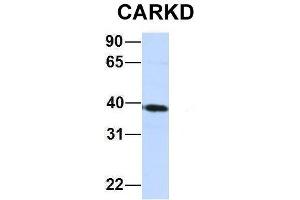 Host:  Rabbit  Target Name:  CARKD  Sample Type:  Jurkat  Antibody Dilution:  1. (Carkd Antikörper  (Middle Region))