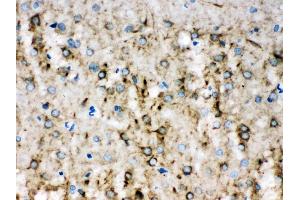 Alpha Internexin was detected in paraffin-embedded sections of rat brain tissues using rabbit anti- Alpha Internexin Antigen Affinity purified polyclonal antibody (Catalog # ) at 1 µg/mL.