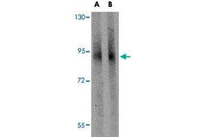 Western blot analysis of GLE1 in mouse brain tissue lysate with GLE1 polyclonal antibody  at (A) 1 and (B) 2 ug/mL .