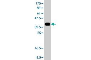 Western Blot detection against Immunogen (37. (Glucose-6-Phosphate Dehydrogenase Antikörper  (AA 401-500))