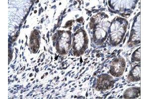Image no. 1 for anti-Hematopoietic Cell-Specific Lyn Substrate 1 (HCLS1) (AA 28-77) antibody (ABIN6735791) (HCLS1 Antikörper  (AA 28-77))