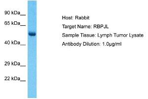 Host: Rabbit Target Name: RBPJL Sample Type: Lymph Tumor lysates Antibody Dilution: 1.
